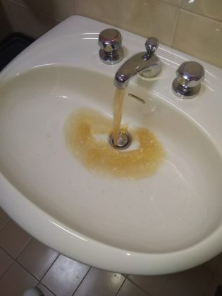 Sdegno di un paziente, esce acqua marrone da un bagno dell’ospedale di Senigallia item-thumbnail