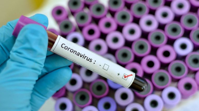 Coronavirus Marche: 492 positivi in 24 ore, 105 nel pesarese. Testati 4817 tamponi Coronavirus Marche: 492 positivi in 24 ore, 105 nel pesarese. Testati 4817 tamponi
