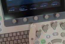 Nuova sonda ecografica per il San Salvatore di Pesaro: diagnosi precoci e sicure per i neonati